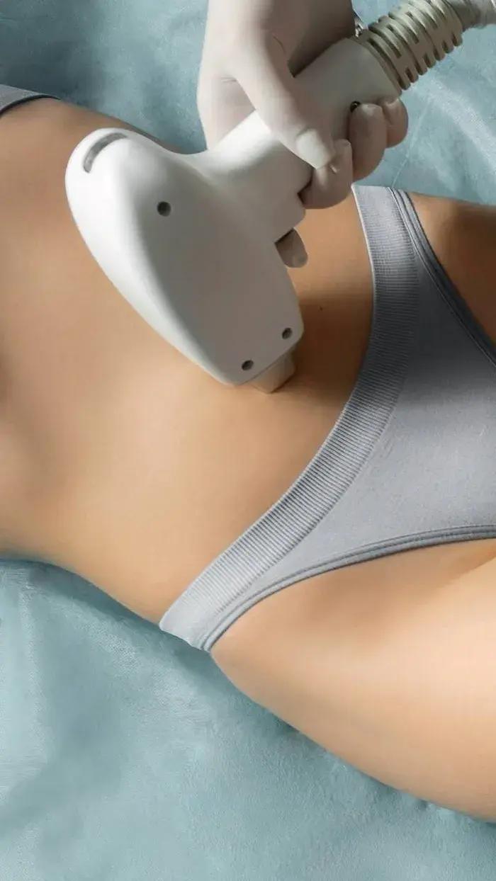 Bikini & Brazilian laser hair removal at Aries Clinic Dubai