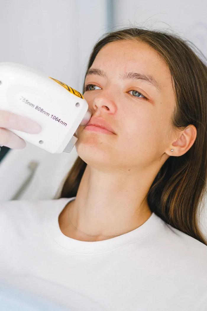 Face & Upper Lip laser hair removal at Aries Clinic Dubai