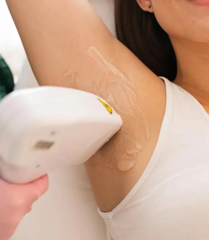 Underarms laser hair removal at Aries Clinic Dubai